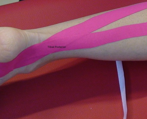 ¿CÓMO MI INICIO EN EL ENTRENAMIENTO DE TRIATLÓN Parte I? Tibial Posterior 3 495x400 - ¿CÓMO MI INICIO EN EL ENTRENAMIENTO DE TRIATLÓN Parte I?
