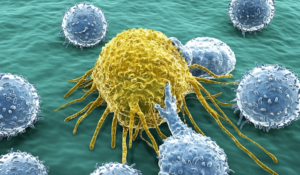 lactato y cancer2 300x175 - lactato y cancer2