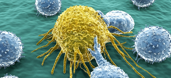 ¿EL LACTATO ALIMENTA A LAS CELULAS CANCERÍGENAS? lactato y cancer2 703x321 - ¿EL LACTATO ALIMENTA A LAS CELULAS CANCERÍGENAS?